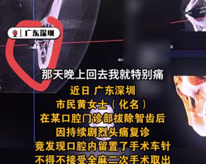 女子拔完智齒頭痛難忍嘴里竟有根針：“一天喝了三次布洛芬”！