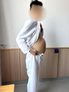 南京一40歲男子4個(gè)月沒排便 便秘痛苦終得解救