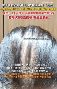 女子脫發(fā)20多年30歲被叫奶奶 自卑到躲衛(wèi)生間哭