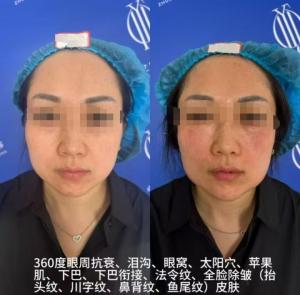 女子貸款4萬花10萬做醫(yī)美崩潰 醫(yī)美機構：對方斷章取義剪輯