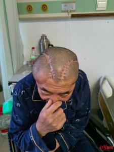 患者右脑出血被开左脑 卫健委回应 手术失误引争议