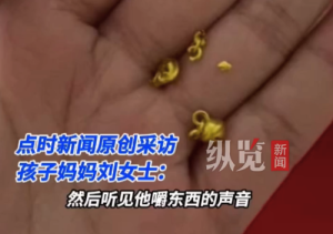 一岁孩子误将金锁咬掉吞下 医生称已到大肠