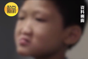 侥幸心理导致二胎三胎唇腭裂儿更多