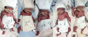 诞下5胞胎女子说现在没时间买黄金 五宝奇迹诞生