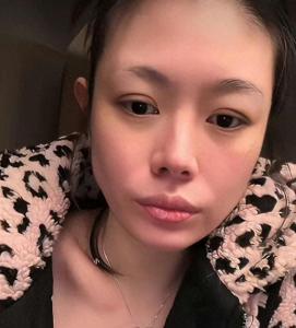 汪峰前妻自曝被男友暴打 已宣布分手 直播揭露家暴真相