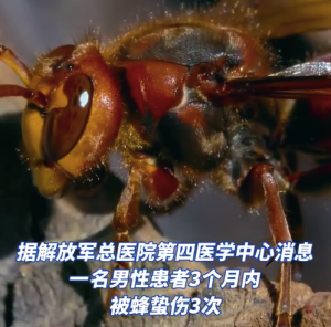 男子3个月内被蜂蛰伤3次险丧命