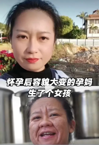 女子怀孕后容貌大变 产后一个月晒照回应 一切都会慢慢变好
