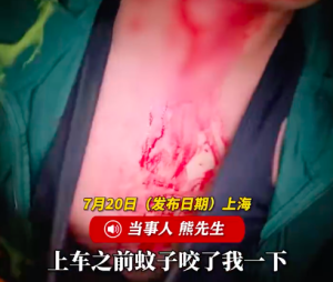 男子被蚊子叮咬脖子血管炸了 鲜血直流