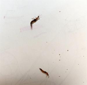 女子徒手掐隐翅虫玩结果中招了 隐翅虫毒液堪比“飞行硫酸”