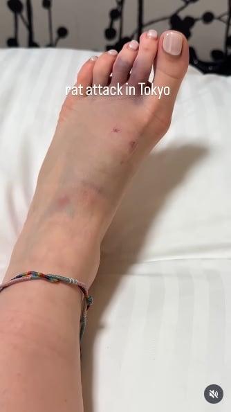 游客称东京街头老鼠“横行” 女游客被咬伤出血