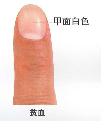 男子手指甲发紫直到胸痛才重视 忽视身体信号险酿大祸