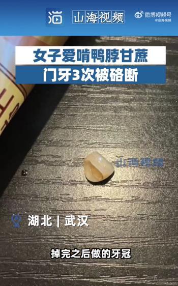 女生爱啃鸭脖甘蔗门牙3次被硌断 吃货自己都觉好笑