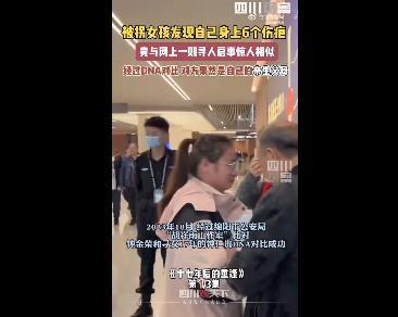 女孩身上6个伤疤同寻人启事一致 失散17年与家人相聚