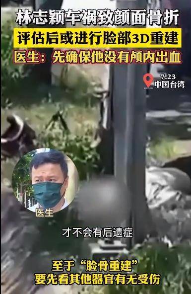 林志颖车祸致颜面骨折，医生：评估后或进行脸部3D重建，有机会重建到受伤前