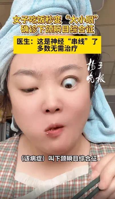 女子一张嘴吃饭眼睛自动变大 罕见病症引关注