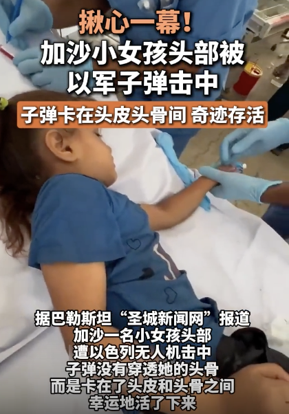 加沙女孩头部中弹奇迹存活，子弹卡在头皮头骨间 幸运生还引发关注