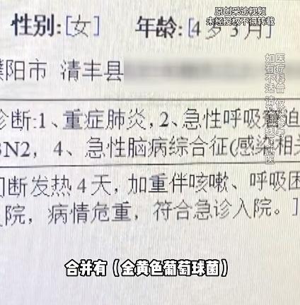 4歲女童甲流合并細(xì)菌感染"白肺" 病情急轉(zhuǎn)直下引發(fā)關(guān)注