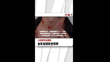 小伙被女友亲后全身抽筋险些晕厥，医生提醒