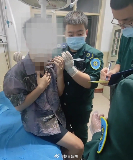 山西臨汾一男子脖子被扎多根燒烤簽