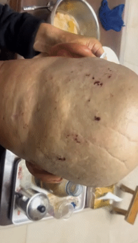 女儿回应老人花10元剃头满头血痂 父亲隐忍引发关注