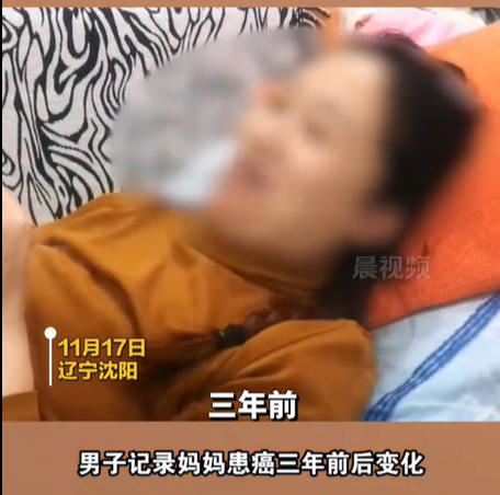泪目!儿子记录妈妈患癌三年的变化，开始笑着给自己打气现在再也笑不出来