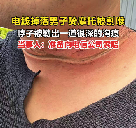 男子骑摩托被掉落电线割喉：准备向电信公司索赔
