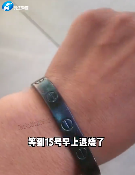女子退烧后发现银手镯变黑了