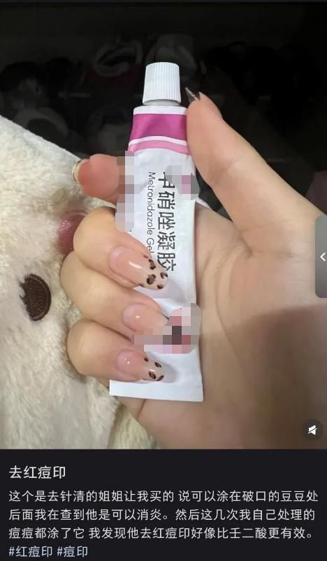 几块钱一支的甲硝唑真不是皮肤神药 别再信这些祛痘偏方