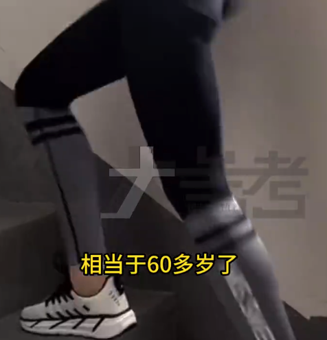 30岁女子爬楼瘦腿膝盖老成60岁 医生提醒：大腿粗小腿细才健康