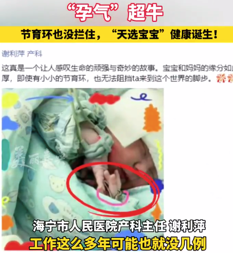 女子带环怀孕诞下孕气超牛天选宝宝 医生：从医多年仅见数例