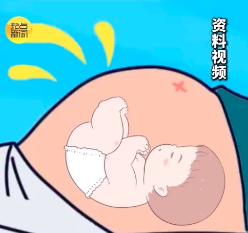 这些征兆一定要警惕！医生称孕反突然消失或和胎停有关
