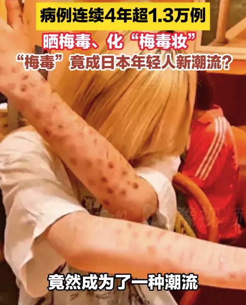 “梅毒”竟成日本年轻人新潮流?日本加强对色情行业监督