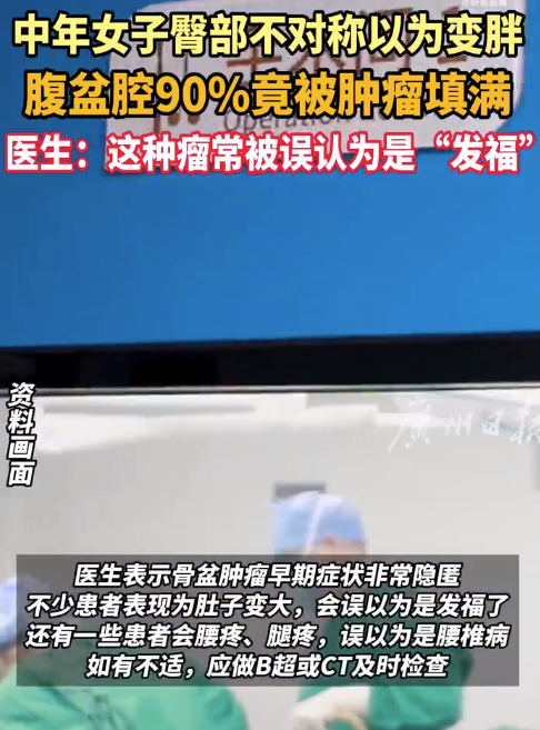 警惕！女子臀部不对称以为发福竟是肿瘤