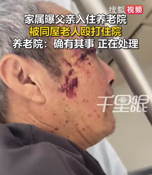 子女曝父亲在养老院遭室友殴打住院 事发2小时才被发现