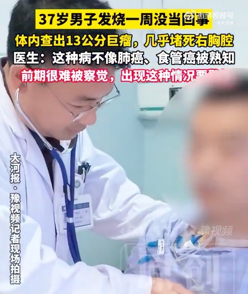 发烧一周男子查出13厘米巨瘤 医生回应