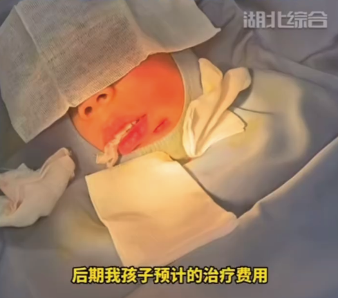 4岁娃游乐场摔倒缝20针 商家赔游戏币