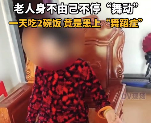 老人高血糖不吃药 身不由己不停舞动竟患上舞蹈症 
