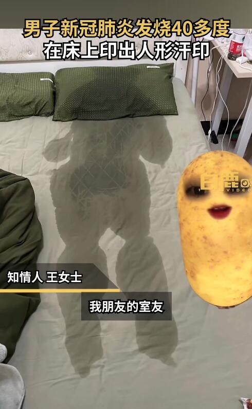 男子发烧近40度床上印出人形汗印