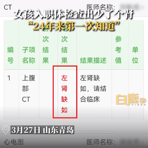山东一女孩体检查出少一个肾 结果父母早就知道了