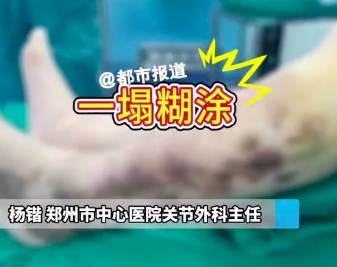 男子爱吃火锅双膝病变无法行走