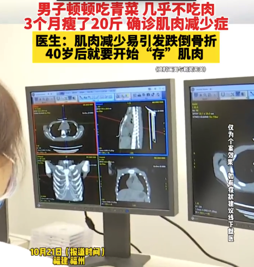 男子三个月只吃青菜确诊肌肉减少症 医生:肌肉减少易引发跌倒骨折,40岁后就要开始“存”肌肉