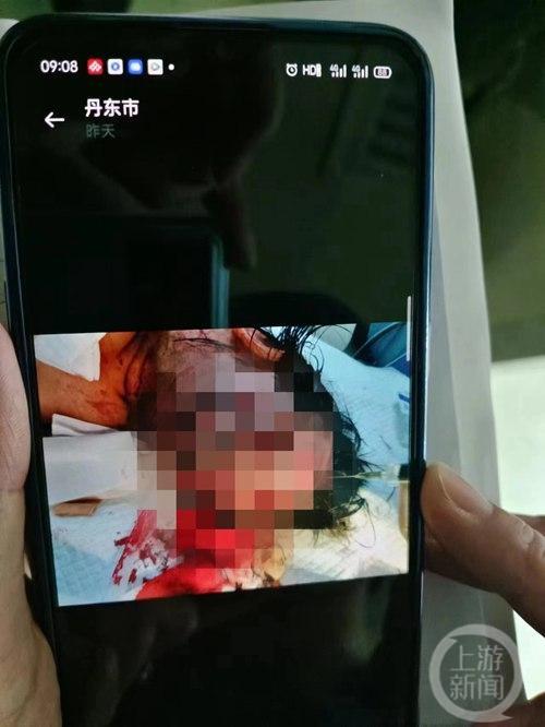 13岁男孩砍伤9岁女童致其缝200针，未满14岁不负刑事责任