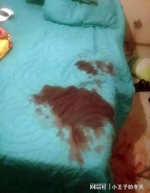 女子剪掉丈夫下体被拘10日罚款200 不至于这么直接没收作案工具吧
