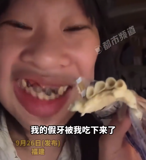天塌了！21岁女生吃饭粘掉4颗牙冠里真牙发黑