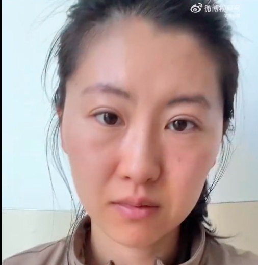 坚持面部刮痧一年的变化！