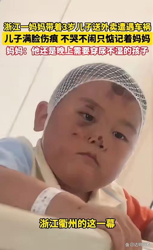 3岁娃满脸伤疤却只担心车祸受伤姆妈 子母温文颠簸全网
