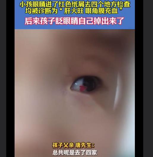 小孩眼睛进纸屑被诊断为肝火旺