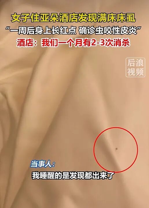 亚朵回应满床虱子女生身体大量红点