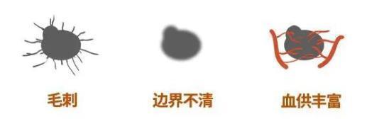 肺癌女性中，98%从不吸烟，钟南山团队回应 二手烟与烹饪油烟成新风险因素