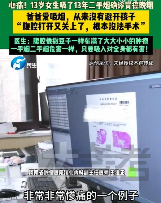 13岁女孩胃癌晚期腹腔长满肿瘤 二手烟害了她